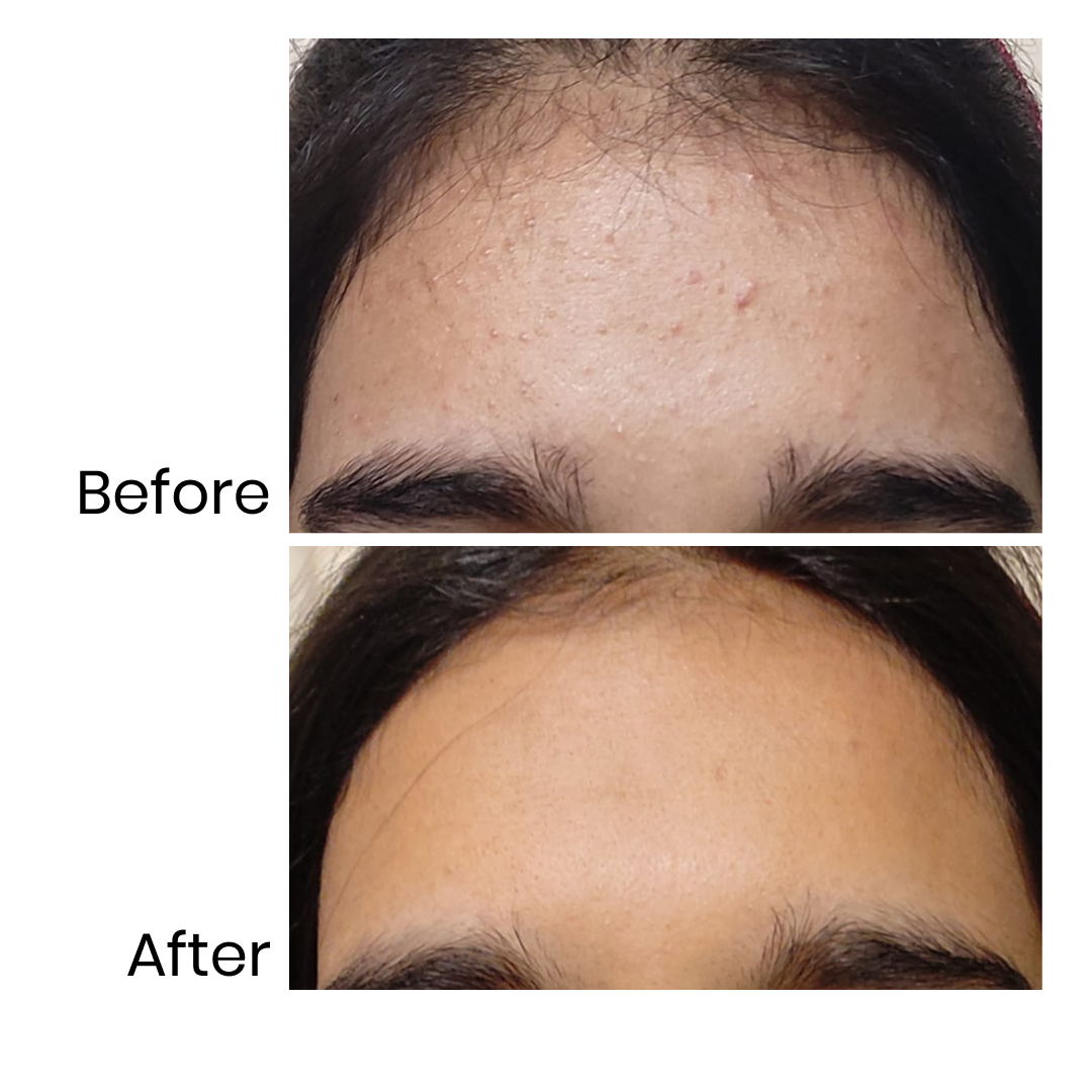 Clarify Me - Exfoliating Serum