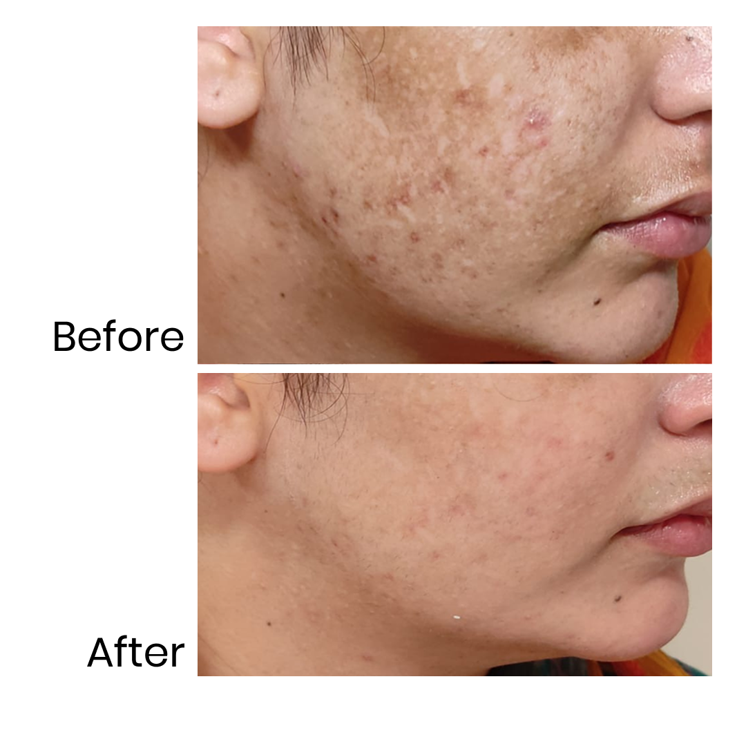 Brighten Me - Vitamin C Serum