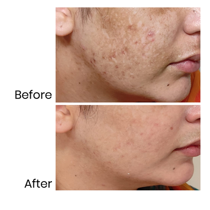 Brighten Me - Vitamin C Serum