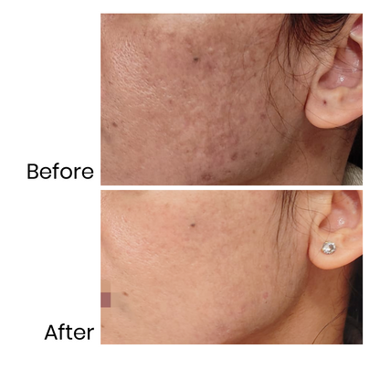 Renew Me - Anti-ageing Serum